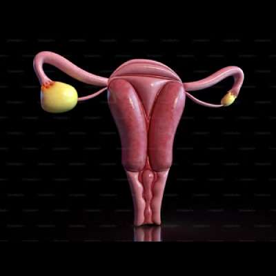 Follicular or ovarian cysts removal