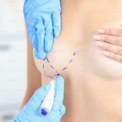 Breast enhancement