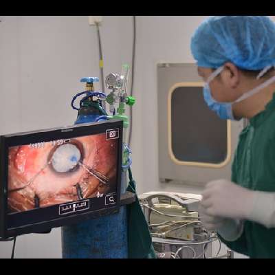 Cataract surgery