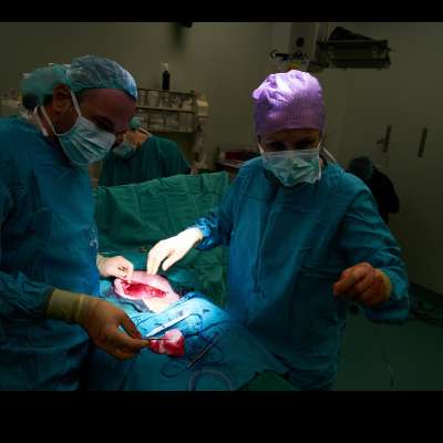 Kidney transplant